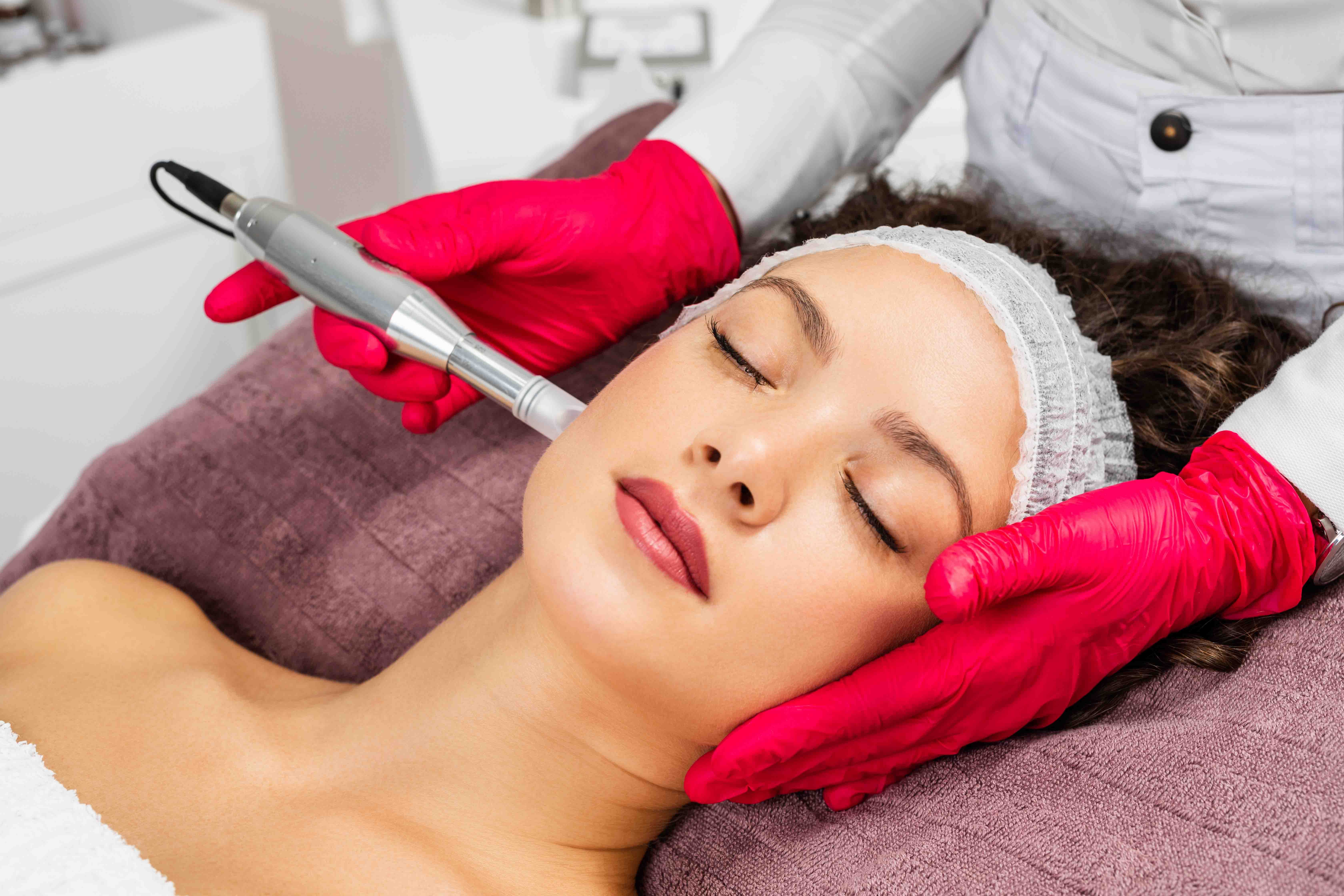 Beautiful woman receiving microneedling rejuvenation treatment. Mesotherapy.